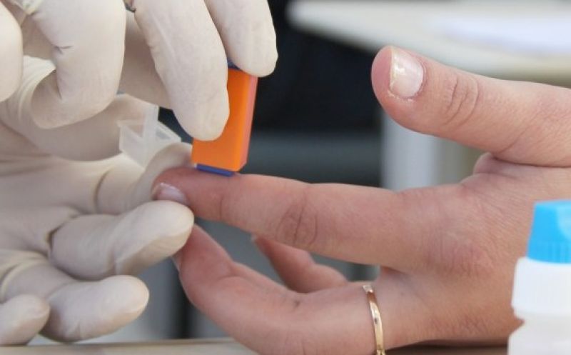 Foto de capa da notícia: UBS OFERECE TESTES RÁPIDOS E GRATUITOS PARA HIV, SÍFILIS E HEPATITES